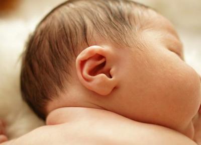 روش های درمانی شکل غیرطبیعی گوش نوزاد چیست؟