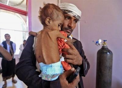 وزیر بهداشت یمن: نصف بچه ها یمن سوءتغذیه شدید دارند، سازمان ملل شریک جنایت های عربستان است