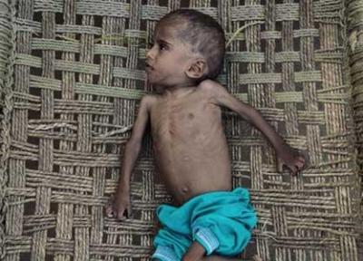 هر پنج دقیقه یک کودک یمنی می میرد